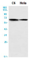 PRKAA2 Antibody in Western Blot (WB)