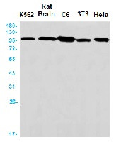 ACTN4 Antibody in Western Blot (WB)