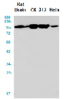 CTNNA1 Antibody in Western Blot (WB)