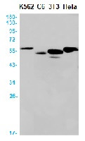 PNPLA2 Antibody in Western Blot (WB)
