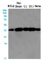 ACTA1 Antibody in Western Blot (WB)