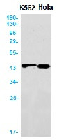 ACAT1 Antibody in Western Blot (WB)