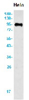 APP Antibody in Western Blot (WB)