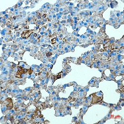 Tlr2 Antibody in Immunohistochemistry (Paraffin) (IHC (P))