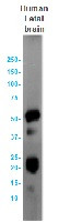 MAPT Antibody in Western Blot (WB)