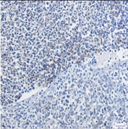 VCAM1 Antibody in Immunohistochemistry (Paraffin) (IHC (P))