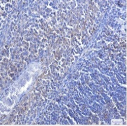 CASP3 Antibody in Immunohistochemistry (Paraffin) (IHC (P))