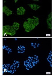 FOXO1 Antibody in Immunocytochemistry (ICC/IF)