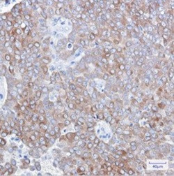 BCL2 Antibody in Immunohistochemistry (Paraffin) (IHC (P))