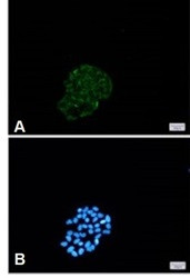 BNIP3 Antibody in Immunocytochemistry (ICC/IF)