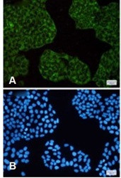 FTH1 Antibody in Immunocytochemistry (ICC/IF)
