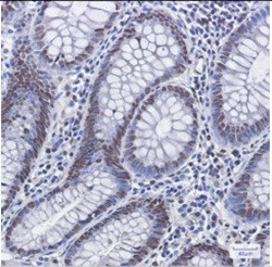 MDM2 Antibody in Immunohistochemistry (Paraffin) (IHC (P))