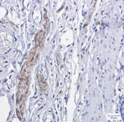 PRKCA Antibody in Immunohistochemistry (Paraffin) (IHC (P))