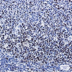 MCM2 Antibody in Immunohistochemistry (Paraffin) (IHC (P))