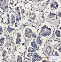 ARPC5 Antibody in Immunohistochemistry (Paraffin) (IHC (P))