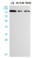 Rb1 Antibody in Western Blot (WB)