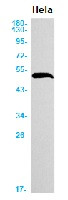 KRT18 Antibody in Western Blot (WB)