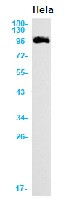 ABCG1 Antibody in Western Blot (WB)