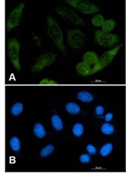 PFN1 Antibody in Immunocytochemistry (ICC/IF)