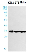 STAR Antibody in Western Blot (WB)