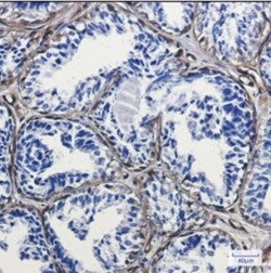 CAV1 Antibody in Immunohistochemistry (Paraffin) (IHC (P))