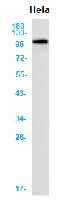 TFRC Antibody in Western Blot (WB)
