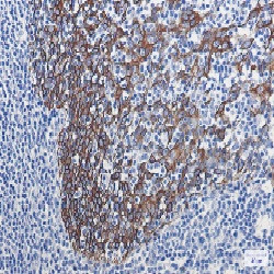 KRT16 Antibody in Immunohistochemistry (Paraffin) (IHC (P))