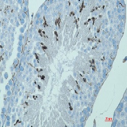 MAGEC2 Antibody in Immunohistochemistry (Paraffin) (IHC (P))