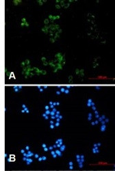 APP Antibody in Immunocytochemistry (ICC/IF)