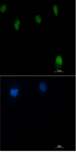 ATM Antibody in Immunocytochemistry (ICC/IF)