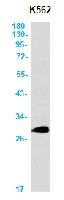 RCHY1 Antibody in Western Blot (WB)