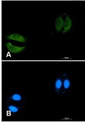 RAB5C Antibody in Immunocytochemistry (ICC/IF)