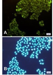 PFKM Antibody in Immunocytochemistry (ICC/IF)