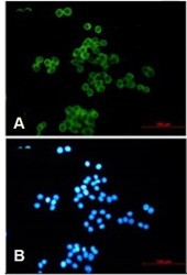 DSC3 Antibody in Immunocytochemistry (ICC/IF)