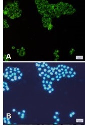 EIF2AK2 Antibody in Immunocytochemistry (ICC/IF)