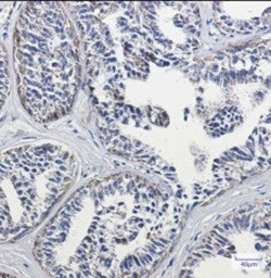 DLD Antibody in Immunohistochemistry (Paraffin) (IHC (P))