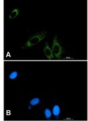 P2RY6 Antibody in Immunocytochemistry (ICC/IF)