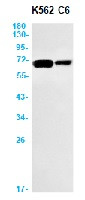MEN1 Antibody in Western Blot (WB)