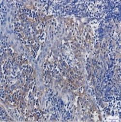 ITGAV Antibody in Immunohistochemistry (Paraffin) (IHC (P))