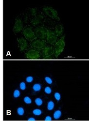 ITGAV Antibody in Immunocytochemistry (ICC/IF)