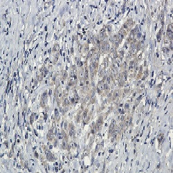PTPN11 Antibody in Immunohistochemistry (Paraffin) (IHC (P))