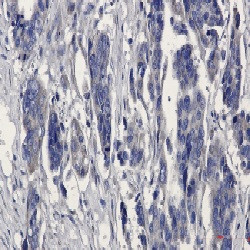 MGST1 Antibody in Immunohistochemistry (Paraffin) (IHC (P))