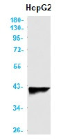 AGTR1 Antibody in Western Blot (WB)