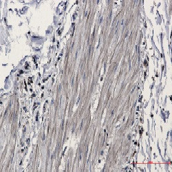 IDH1 Antibody in Immunohistochemistry (Paraffin) (IHC (P))