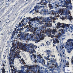 MMP14 Antibody in Immunohistochemistry (Paraffin) (IHC (P))