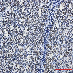 MCM6 Antibody in Immunohistochemistry (Paraffin) (IHC (P))