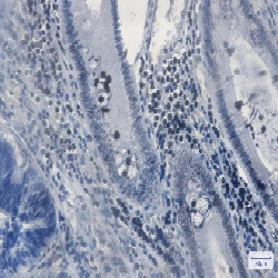 MGMT Antibody in Immunohistochemistry (Paraffin) (IHC (P))
