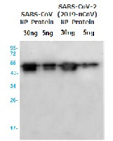 SARS-CoV Nucleoprotein/NP Antibody in Western Blot (WB)