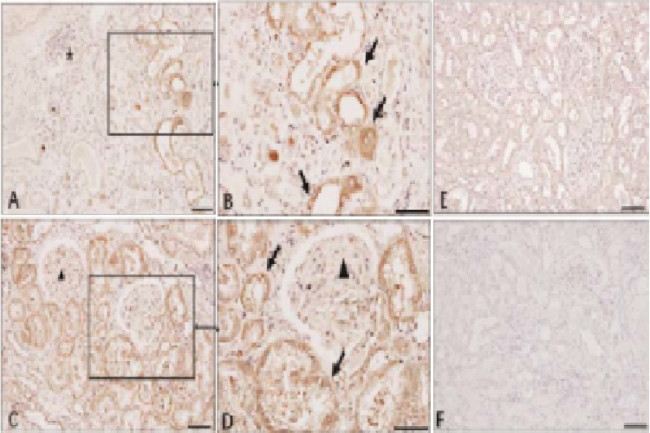 SARS-CoV-2 (2019-nCoV) Nucleoprotein/NP Antibody in Immunohistochemistry (Paraffin) (IHC (P))