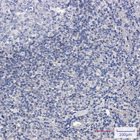 ADK Antibody in Immunohistochemistry (Paraffin) (IHC (P))
